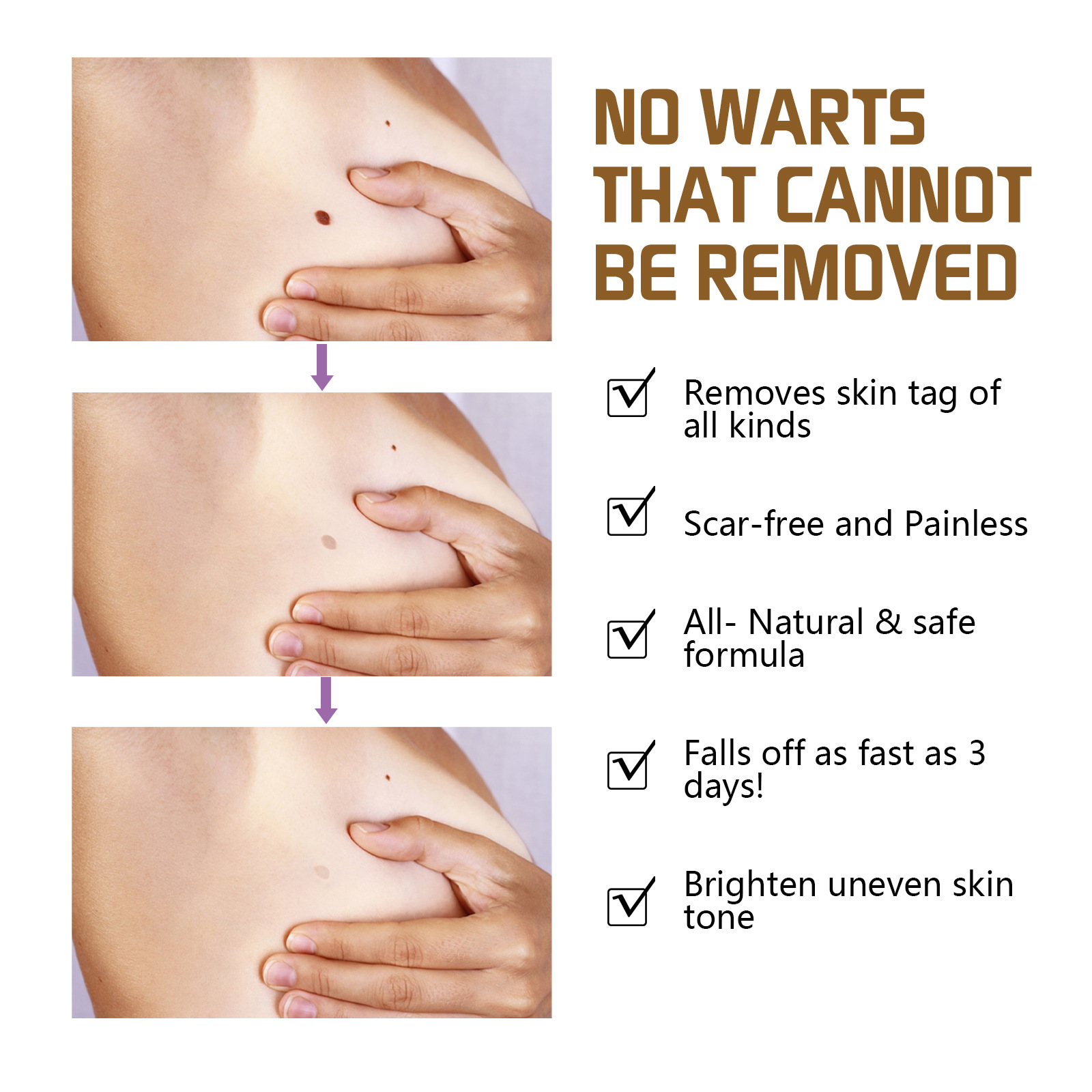 EELHOE wart oil repair for warts, black facial convex nevi, anti mole scar free nevus cocoon, clear and smooth skin_voghion.com