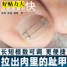 正甲丝正甲贴镍钛合金记忆回弹正甲钢丝指甲扎肉嵌甲矫正器正甲扣