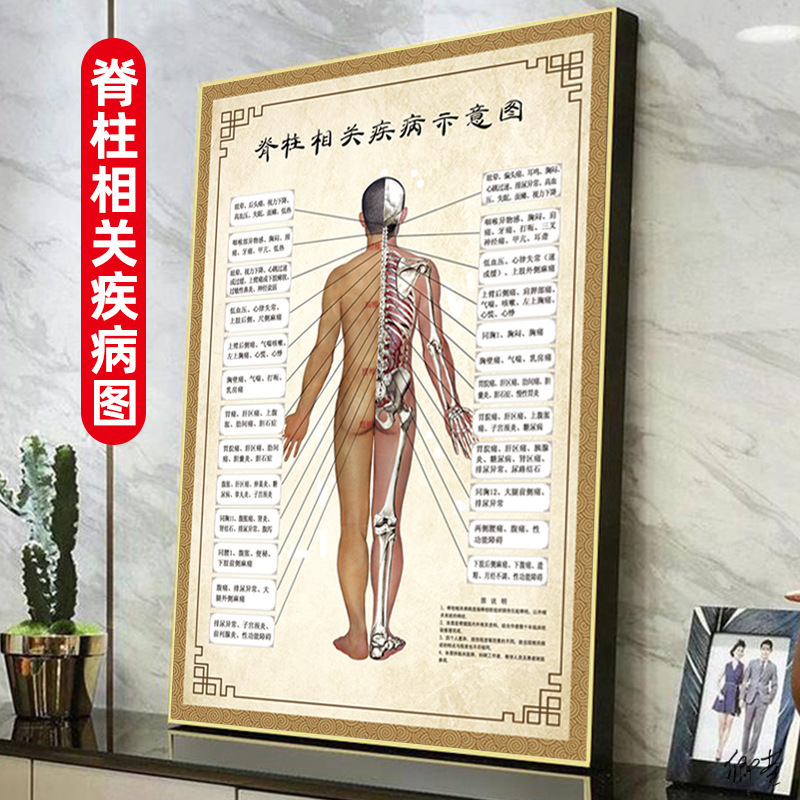 中医穴位挂图院美容院挂画示意图按摩脊柱中医馆相关图解