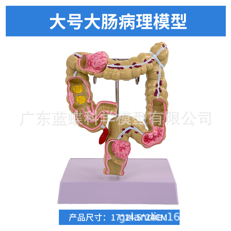 ��ѧ��������󳦲���ģ�ͳ�θֱ���̴�������ʳ��������᳦����