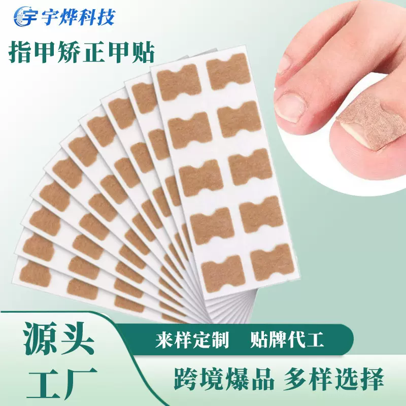 指甲矫正贴脚趾甲贴片甲沟贴片免胶水正甲贴嵌甲矫免粘