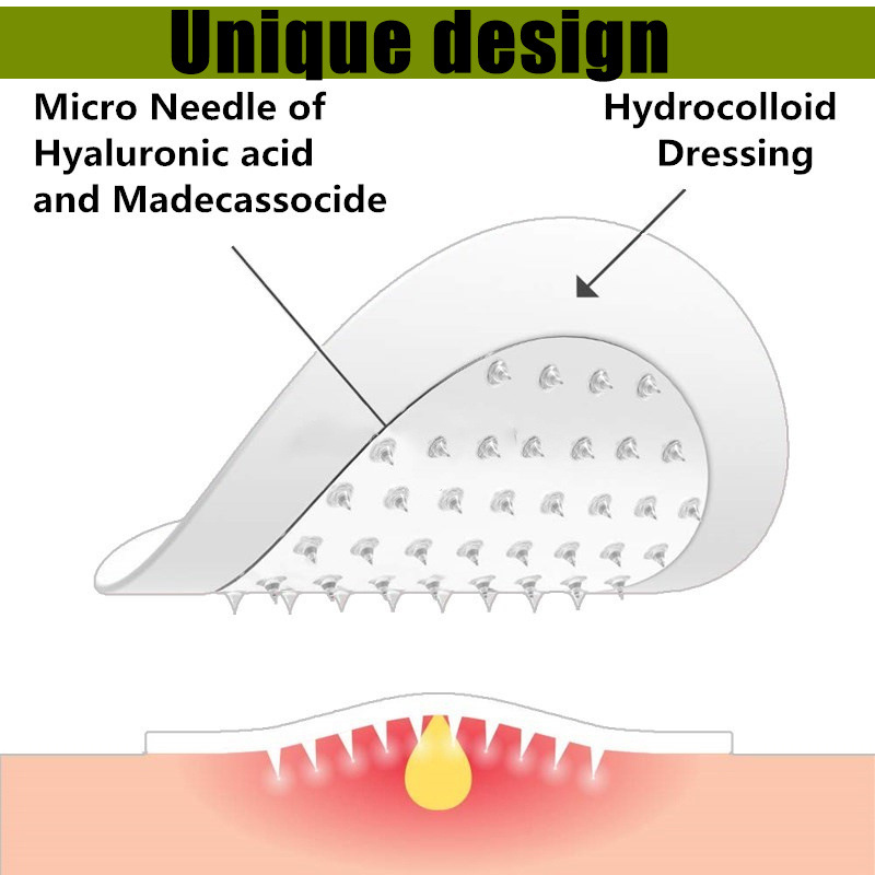 Title 3, Hyaluronsäure-Mikronadel-Akne-Patch
