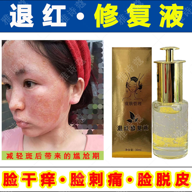 Epidermal repair liquid thickening the stratum corneum is awkward.