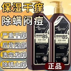 Qiao Fu Li 蛇胆硫黄シャワージェル鎮静かゆみ止めダニ除去ディープクレンジングソープ液体皮膚かゆみ硫黄シャワージェル
