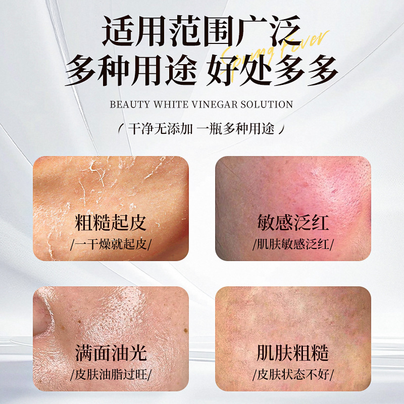 律菲美容白醋液保湿水润质地清爽改善粗糙干燥温和呵护持久爆品|undefined