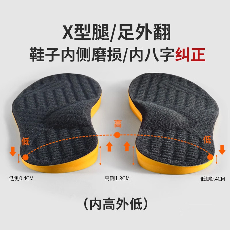 El cabello de alta velocidad para hombres y mujeres, piernas hermosas, pies planos internos y externos, pies en forma de O, arco adecuado para plantillas de corrección en forma de X