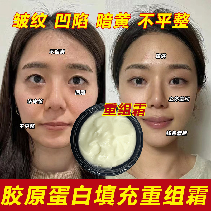 Recombinant Type III Humanized Collagen Cream Anti-Wrinkle Tightener Anti-Elaptic Filling Wrinkles Law Stripe Essence Cream