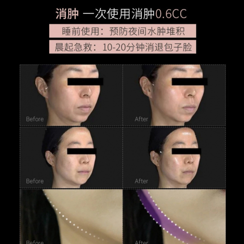 韩国丽菲同款5D绷带面膜 提拉紧致脸部塑形保湿淡化细纹面膜|undefined