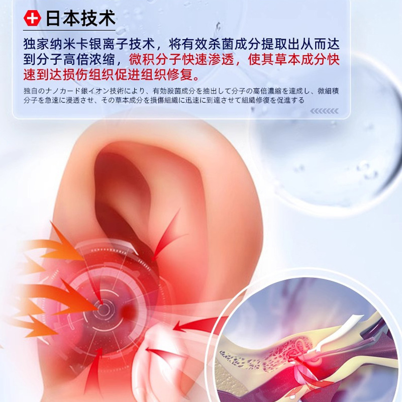Jiuyan Pharmaceutical 本物の耳鳴りツボ石膏耳鳴りパッチ特別な耳鳴り神経耳鳴り耳鳴り|undefined