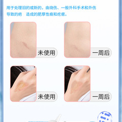 Silicone Scar Repair Gel Post-Surgery Scar Fade Cream for Qu Scar Burn Scald Old and New Hypertrophic Scar Repair Cream