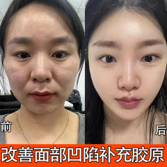 胶原蛋白填充霜重组霜去法令纹抬头纹去皱紧致保湿补水正品面霜