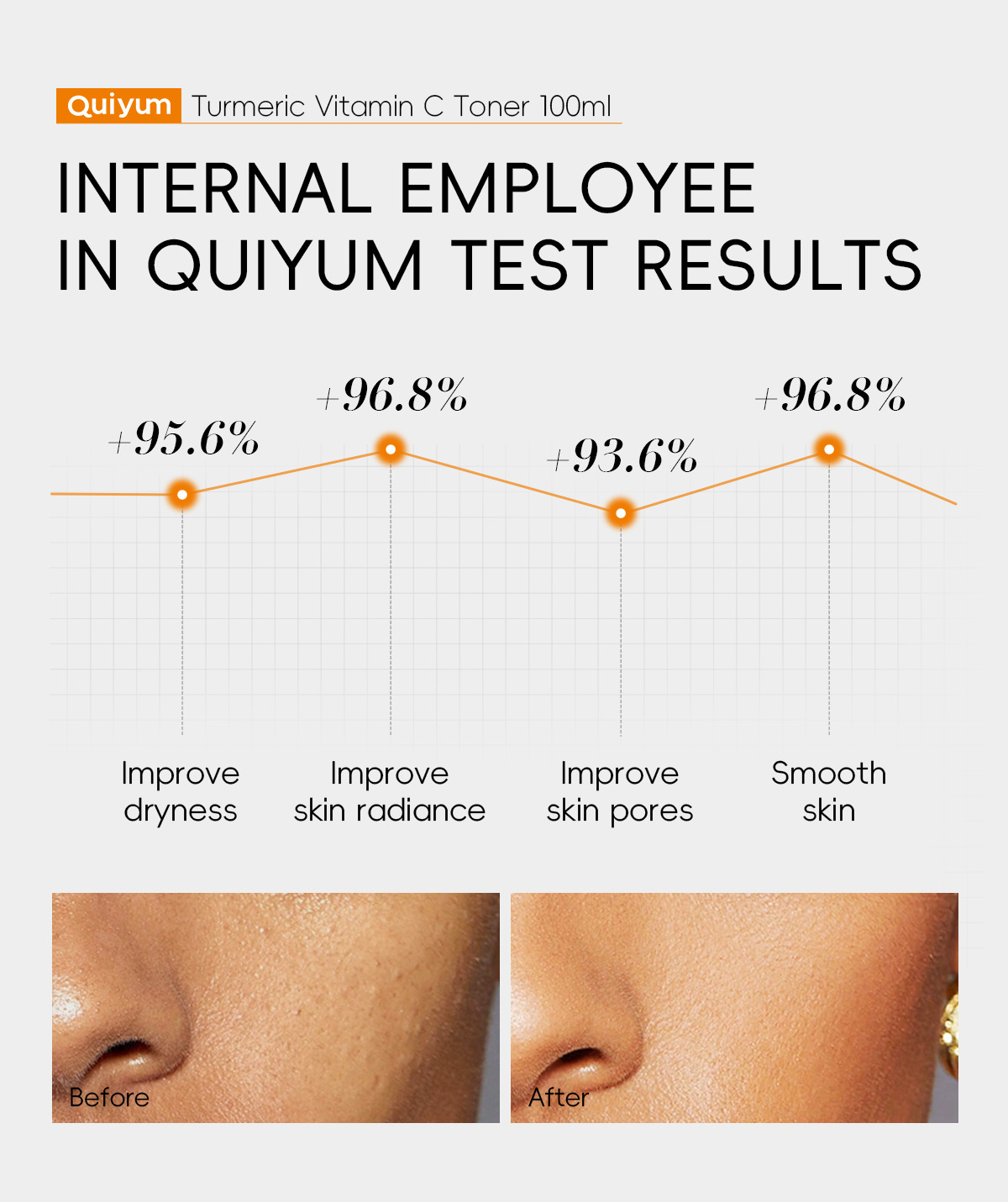 Cross-border new product QUIYUM Turmeric Vitamin c Toner 100ml for hydrating and moisturizing the face is available for wholesale from the manufacturer undefined
