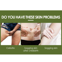 EELHOE Retinol Body Cream for Shaping, Moisturizing, Brightening Skin Tone, Fading Fine Lines, and Softening Skin