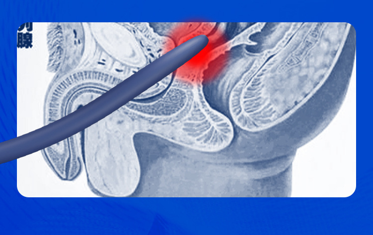 Turtle Catching Horse Eye Stick Male Masturbation Device Multi-Frequency Strong Shock — detail image 13
