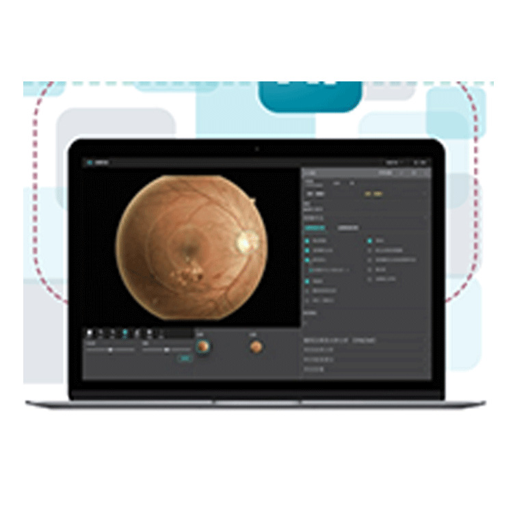 TNF300�����۵������  ����Ӱ��ɸ�� С�ɱ�� �����۵������