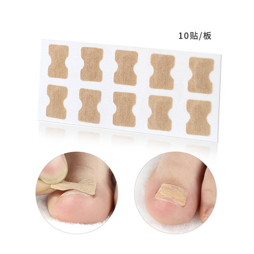 Glue-free nail patch, toenail nail groove, ingrown toenail, orthopedist, toenail patch, pull-up manicure shoes