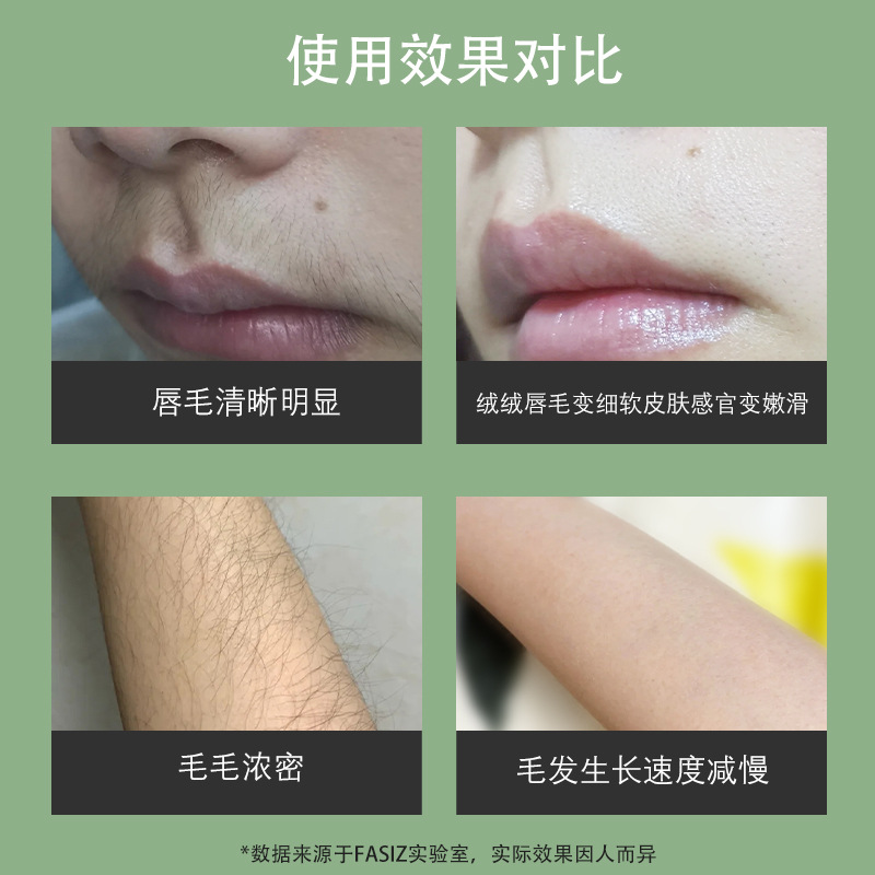 厂家批发IPL温感无痛脱毛仪美容院激光嫩肤脱毛便携女士脱毛仪