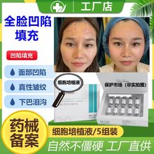 暨大深导体细胞面部填充凹陷真性皱纹冻干粉5ml外泌体 活细胞填充