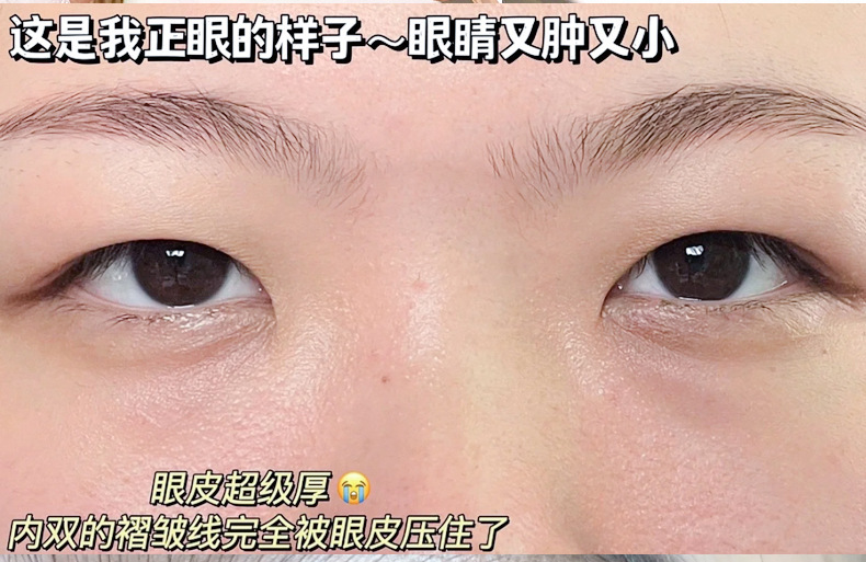 xixi Natural Invisible and Seamless Lace Double Eyelid Stickers, Olive-shaped puffy eye Self-Adhesive Invisible Beauty stickers for beginners undefined