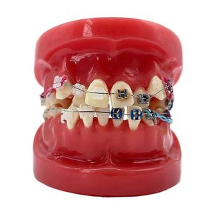 Dental Oral Teaching Model Orthodontic Correction Model Metal Ceramic Self-Locking Bracket Misalignment Orthodontic Demonstration Model