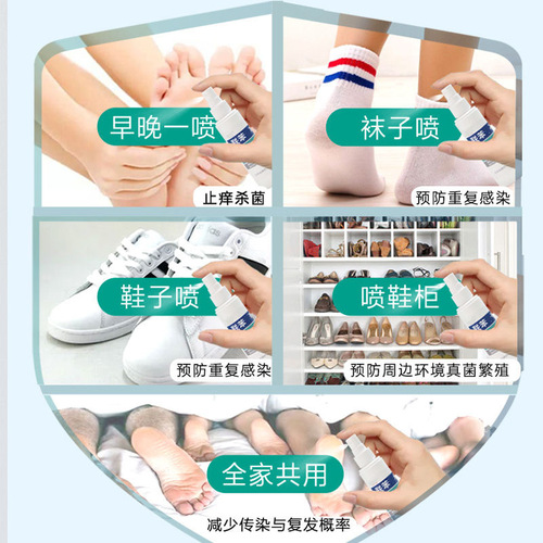 Biphenyl Aerosol Benzoyl Benzoic Acid Skin Biphenyl Benzoyl Socks Itchy Feet Foot Odor Peeling Tinea Corporis Antifungal Lotion Anti-Itch