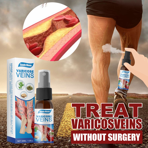 South Moon Vein Massage Varicose Vein Spray Smoothes Blood Vein Bulges Smoothes Earthworm Legs Leg Massage