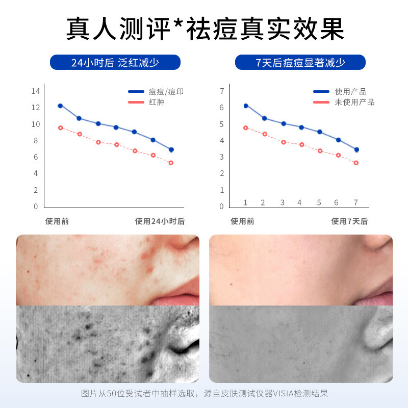 壬二酸祛痘洗面奶滋潤淨顏潔面乳除蟎控油清潔閉口粉刺款批發