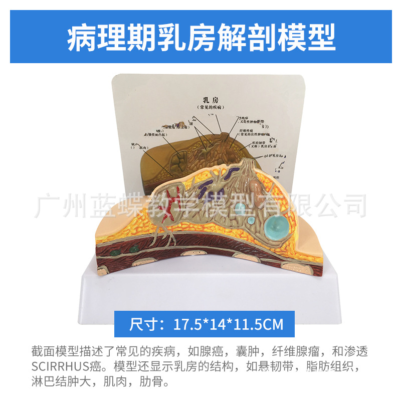 ��ѧ���沸����Ů���鷿����ģ�;�ֹ���ز��ṹģ�߲�����������