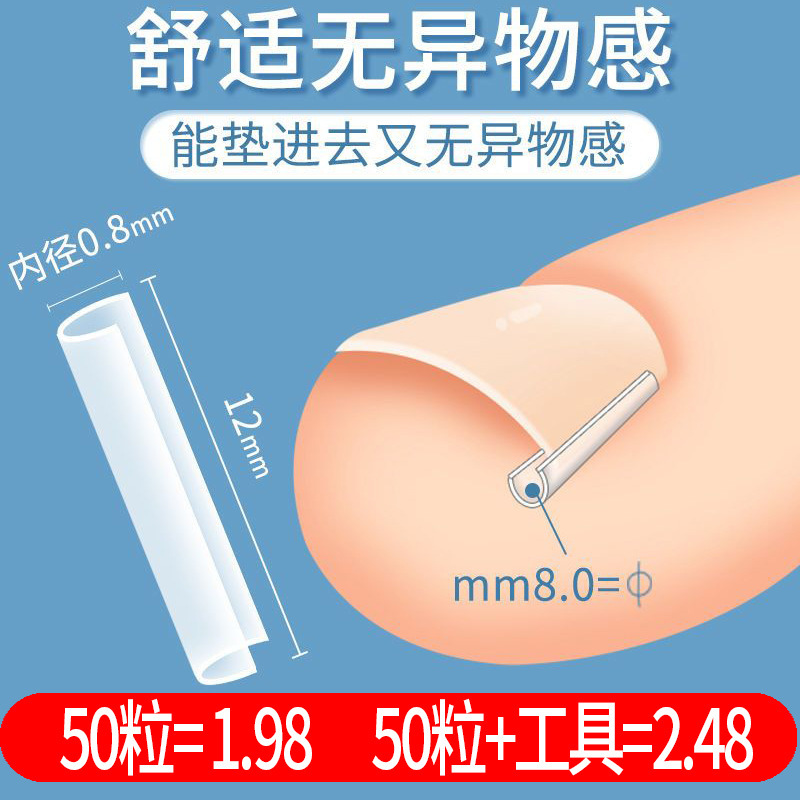 甲溝は甲の矯正器の正甲のパッドを入れて爪を詰めて肉の中に長い隔離パッドを入れて足の爪のパッチ炎を是正します。|undefined
