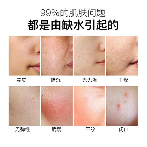 Demi-season nutritious Vitamin E anti-dryness