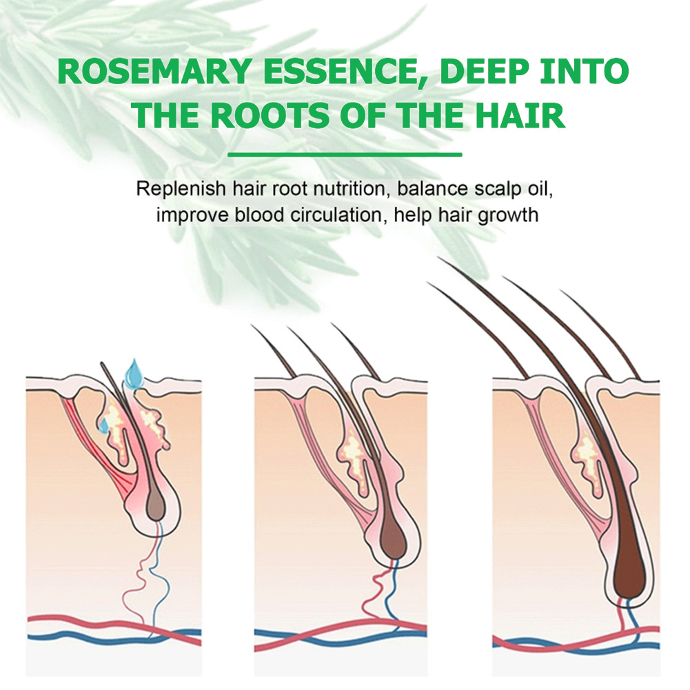 Cross-Border Herbal Hair Oil Rosemary Anti-Hair Loss Anti-Breakage Scalp Massage Oil Thickening Hair Care Essential Oil Hairline
