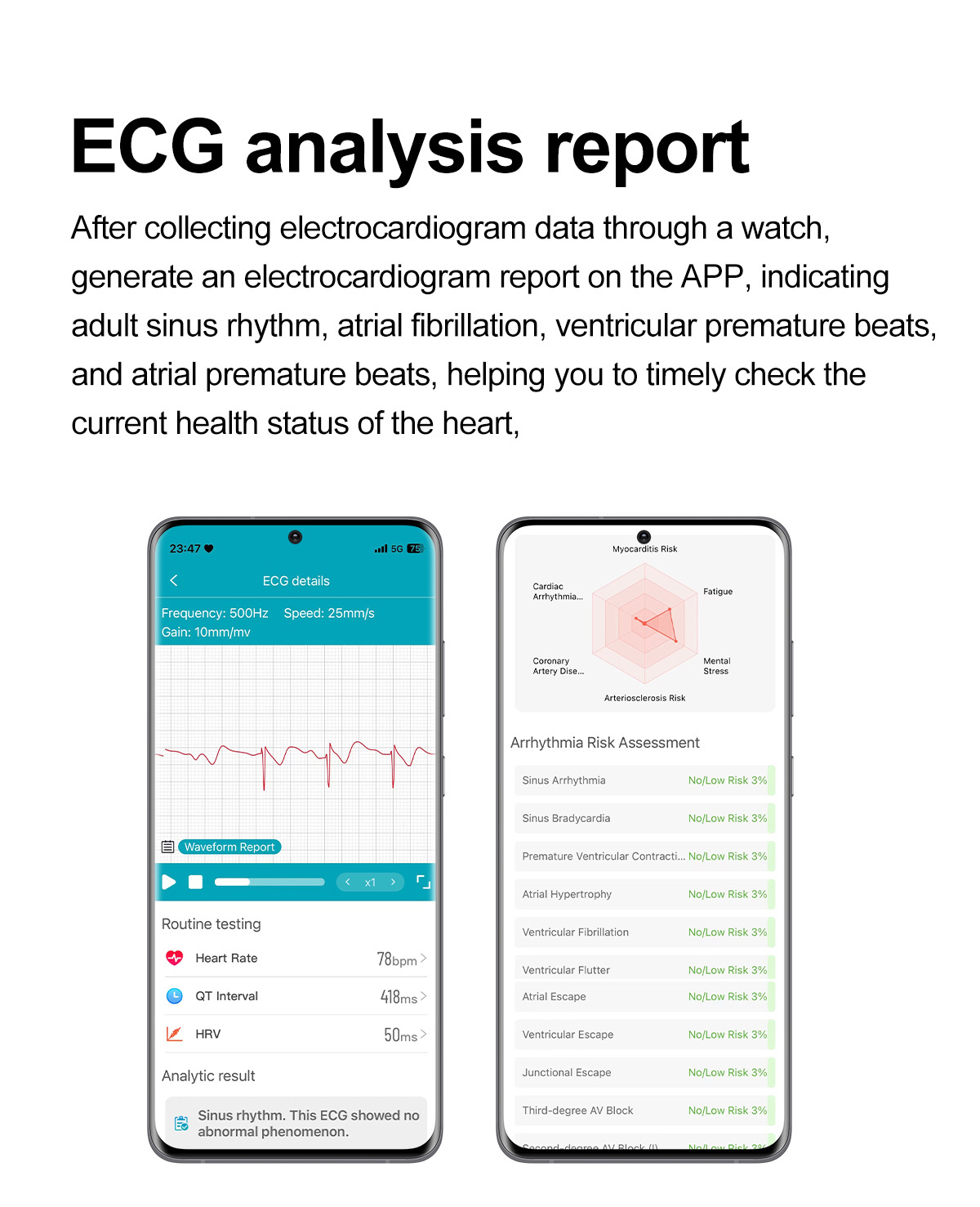 Smartwatch With Ecg Bluetooth Calling Heart Rate & Body Temp_voghion.com