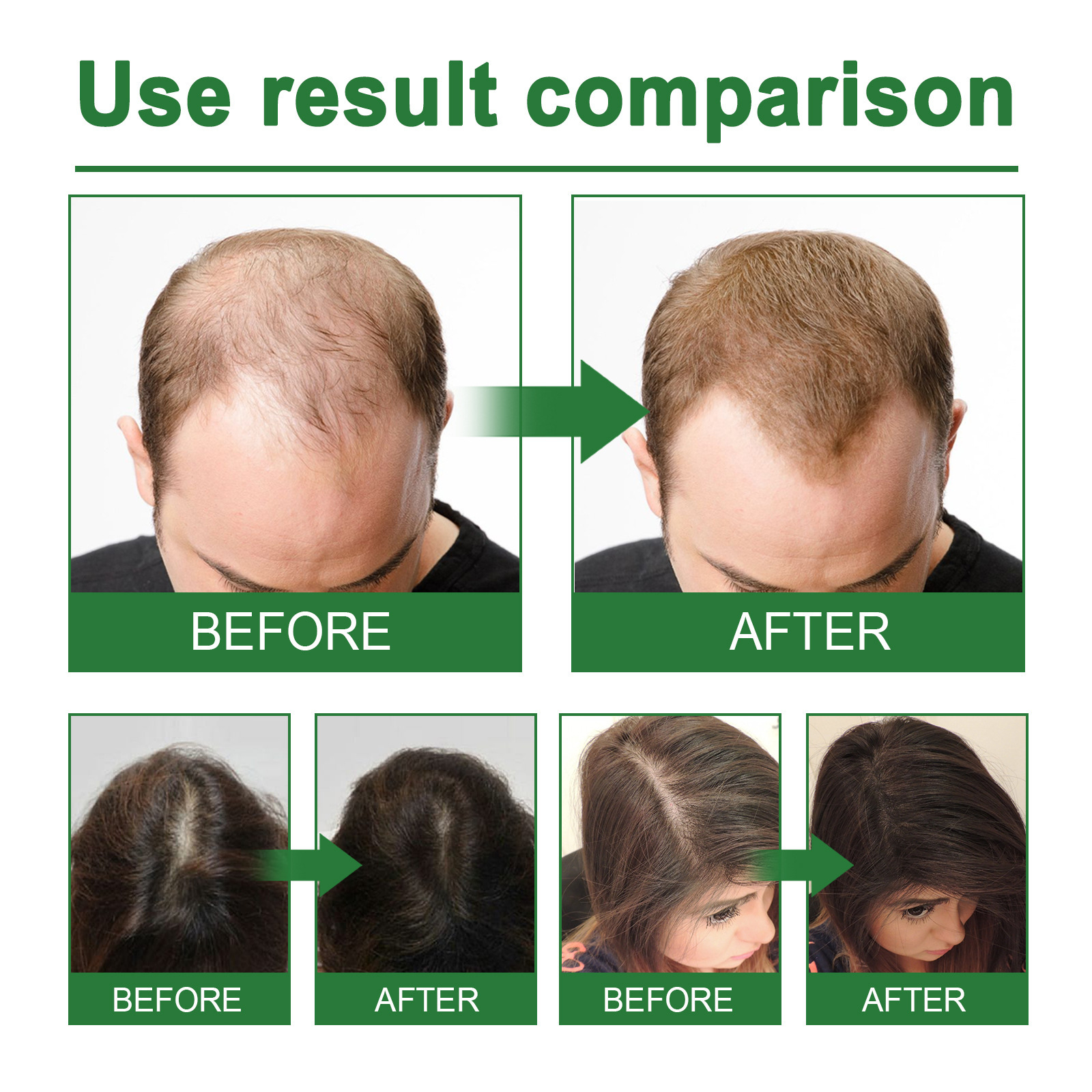 EELHOE Spray espesante para cabello con romero Hidrata las raíces del cabello, repara el cabello dañado, fortalece el cabello y previene la caída del cabello._voghion.com