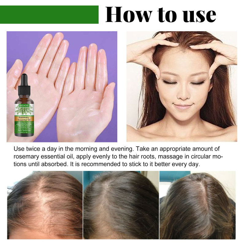 EELHOE ローズマリーナリッシングヘアケアエッセンシャルオイル抗損失成長ヘアエッセンシャルオイル抗損失ヘアケア頭皮エッセンシャルオイル|undefined