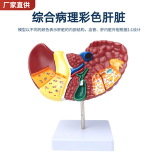医学仿真人体肝脏解剖模型肝门胆囊胆管结构消化系统器官演示教具-阿里巴巴
