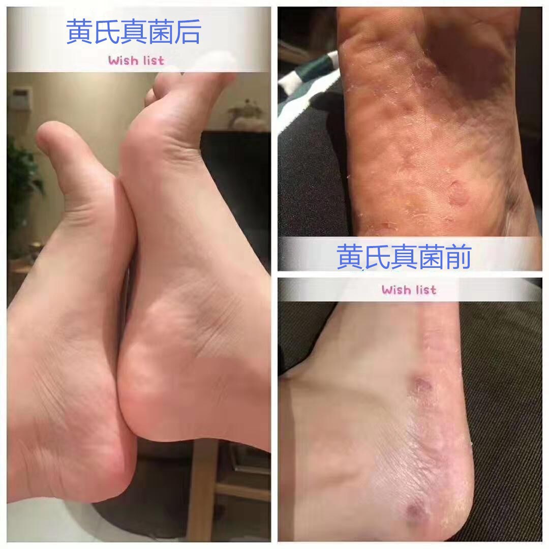 carousel-thumb-1
