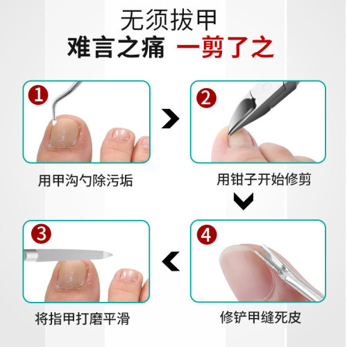 Ingrown Toenail Nail Clipper Set for Toenails, Toe Nail Correction Scissor with Beveled Blade, Household Adult Pedicure Tool