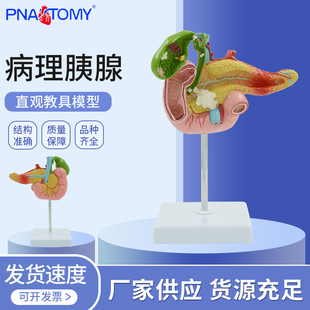 教学仿真 病变胰脾肝胆十二指肠模型 病理胰腺标本 胰脾肝胆解剖-阿里巴巴