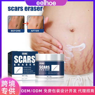 EELHOE Scar Desalination Ointment Surgical Scar Repair Ointment Cold Compress Burning Scar Ointment Skin Scar Gel Ointment