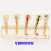 Dental teaching model doctor-patient communication model comprehensive case model removable dental model implant restoration model