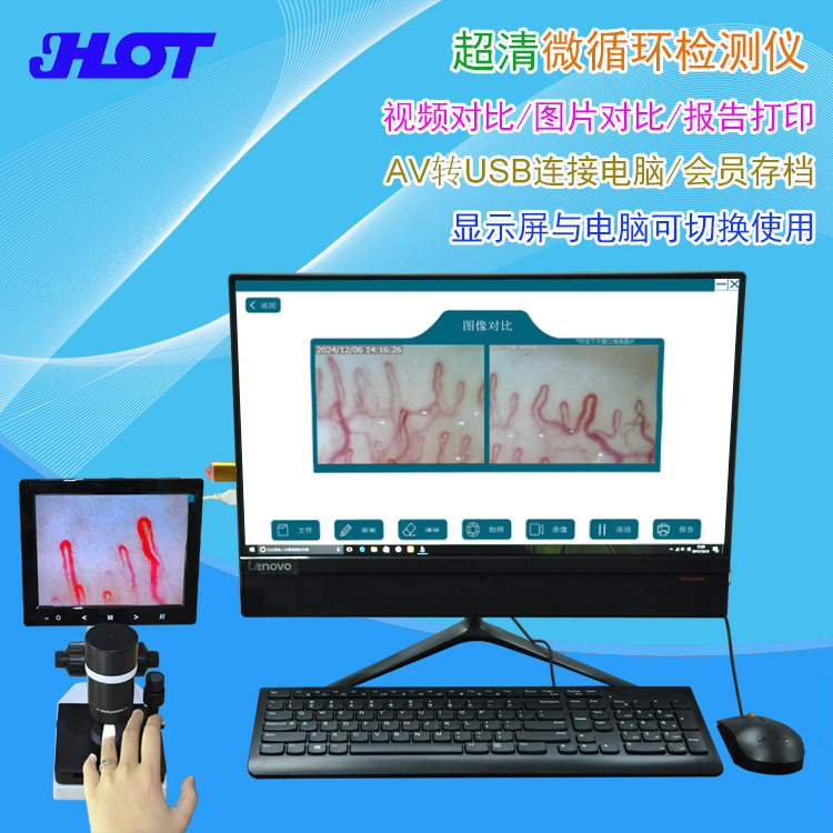 跨境 超清专业甲壁微循环末梢血管检测仪拍照视频存档报告打印