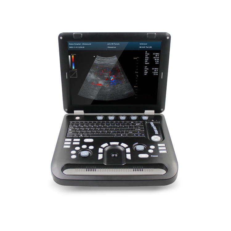 Kantai veterinario instrumento de diagnóstico de ultrasonido de imagen de ultrasonido de color animal portátil máquina de ultrasonido de color b fabricante