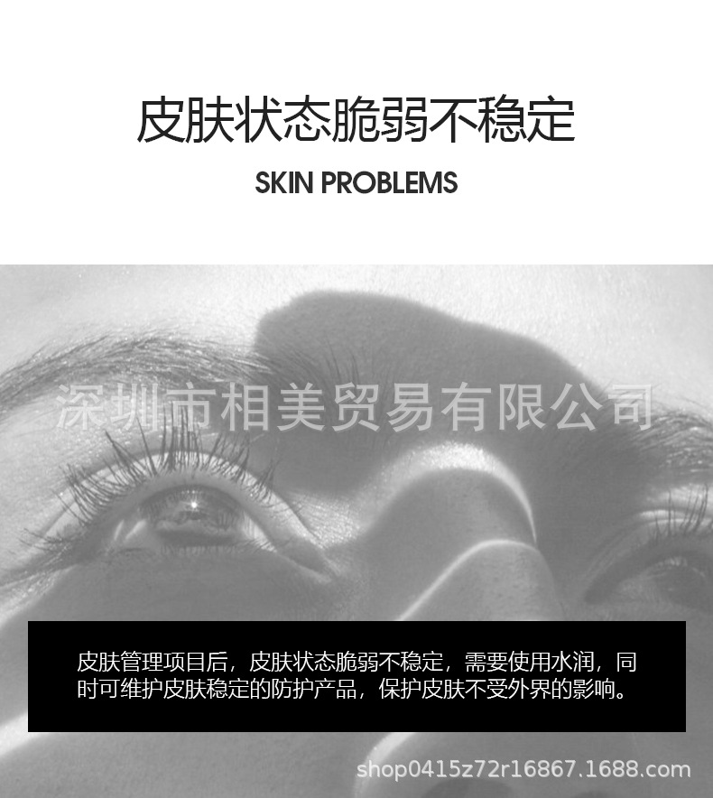 Sun protection details_02