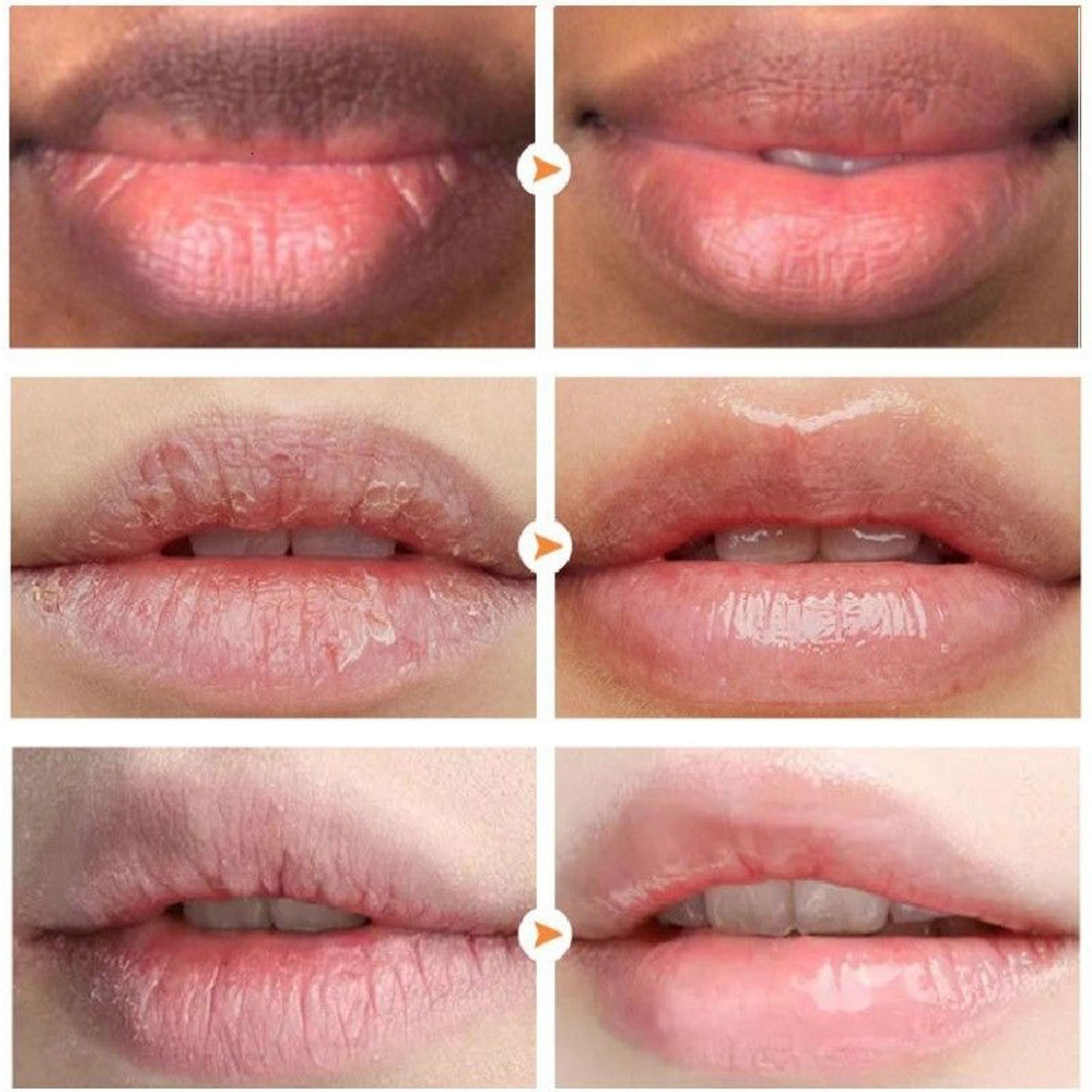 Rossetto Hoygi Fade Cura Anti screpolature della pelle morta Idratante e indebolente le linee delle labbra nere_voghion.com