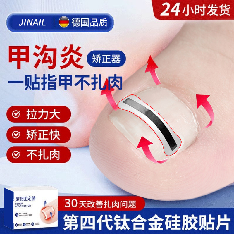 Jiagou nail inlaid steel wire nickel-titanium alloy bionic bone patch nail nail nail nail prick inflammation corrector