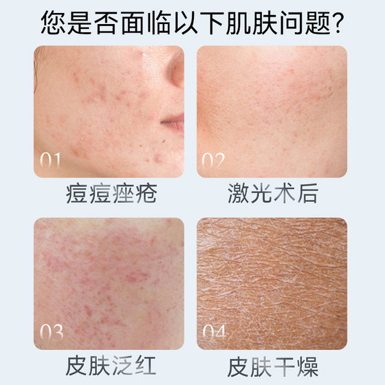 Tuoneng pharmaceutical medical repair patch post-operation repair acne sensitive skin repair patch anti-acne marks dressing medical beauty