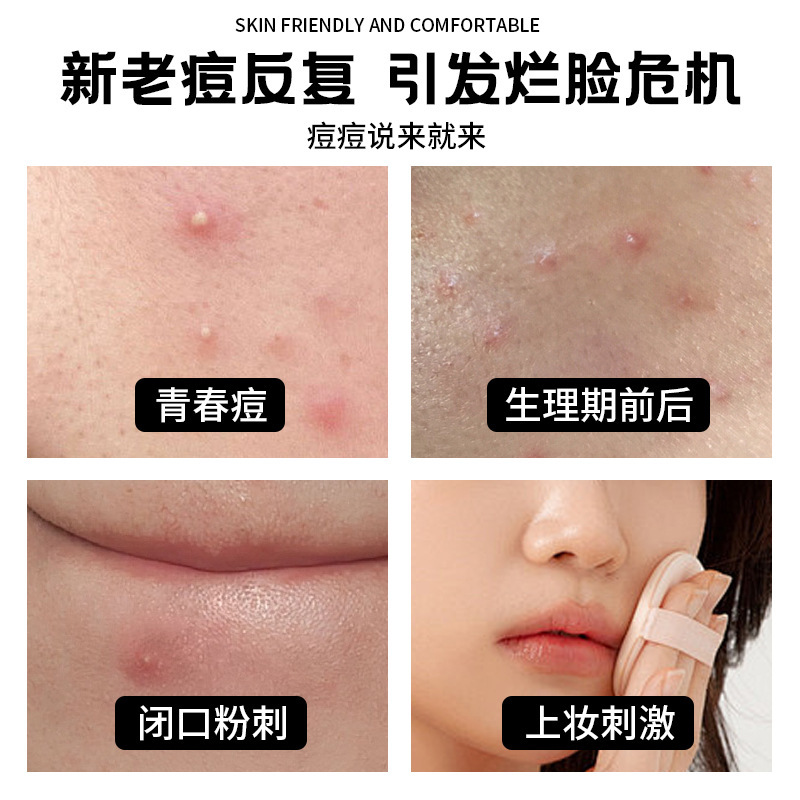 哇噢定制亚马逊水胶体星星痘痘贴彩色36粒痘痘贴净痘遮瑕祛痘痘贴|undefined