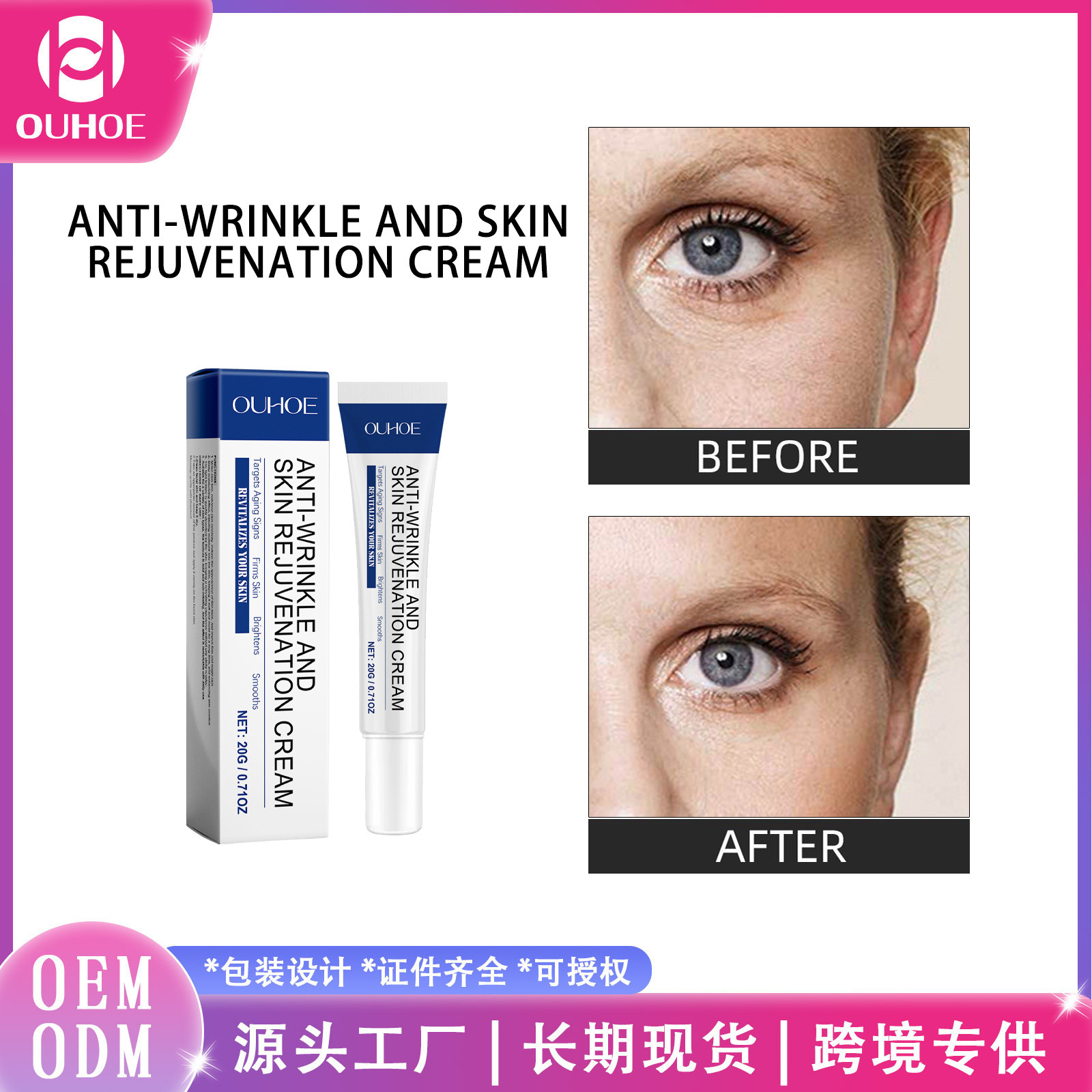 OUHOE Medical soft moisturizing brightening elastic cream for face