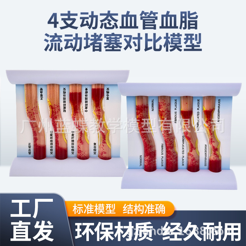 Ѫ�ܷ������Ѫ֬��Ѫ֬ģ�Ͳ�����̬Ӳ������Ѫ˨ֱ�۽�ѧ����