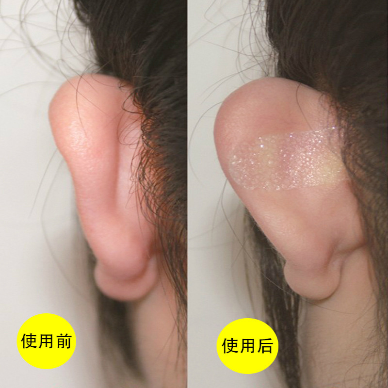 精霊の耳は顔の小さい固定を貼って風の耳をつけて隠れている耳を貼って耳のシリコンの耳飾りを矯正します。|undefined